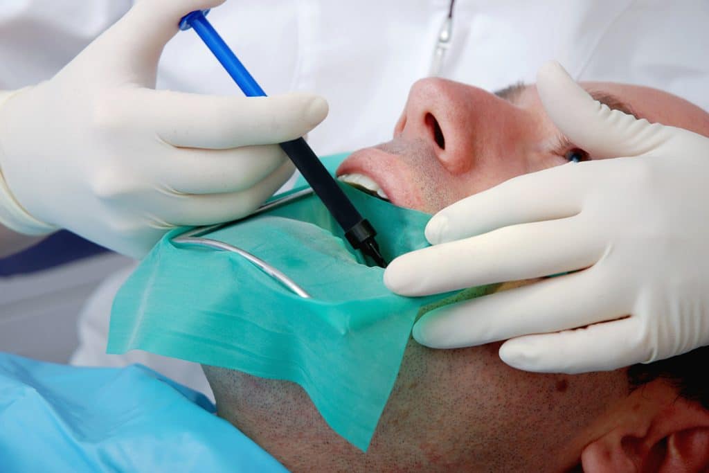 Can A Root Canal Be Done On A Cracked Tooth?